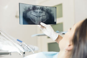 http://welldentclinic.ru/wp-content/uploads/2020/08/dental-x-ray.jpg