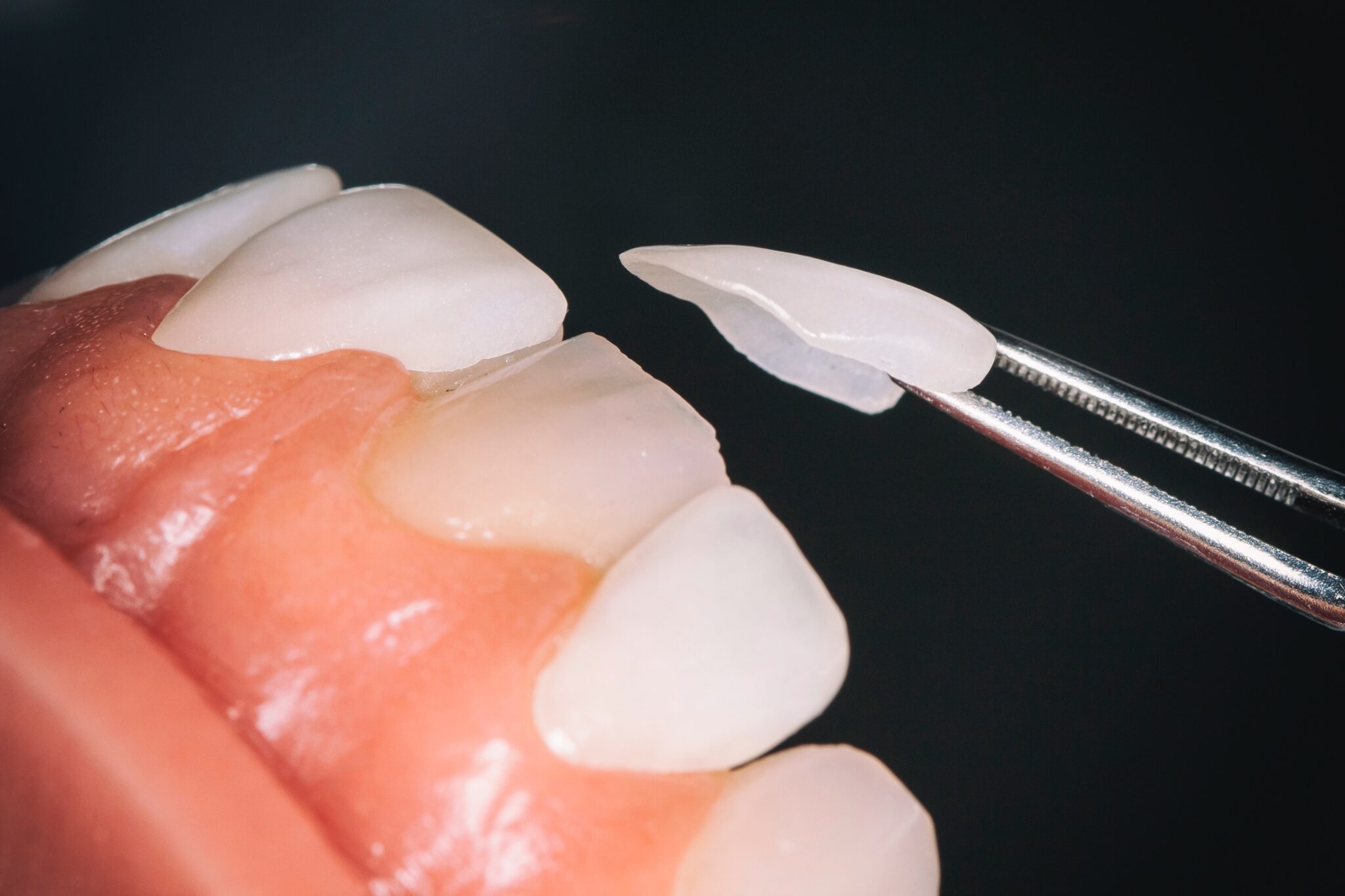 https://welldentclinic.ru/wp-content/uploads/2022/03/peter-kasprzyk-1112591-2048x1365-1.jpg